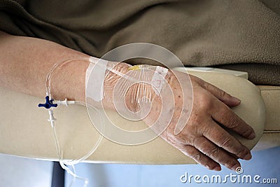 Cancer chemo therapy treatment hand Editorial Stock Photo