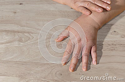 Cancer chemotherapy cause swelling hand , skin to become dry. Stock Photo