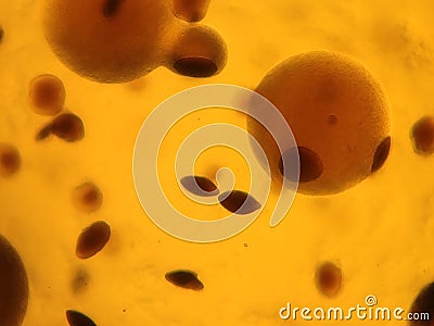 Candida albicans and bacterial colonies under the microscope Stock Photo