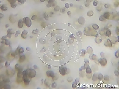 Candida albicans under the microscope Stock Photo