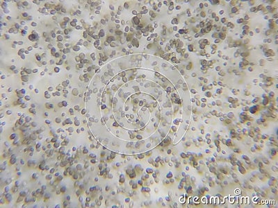 Candida albicans under the microscope Stock Photo