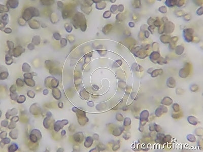 Candida albicans under the microscope Stock Photo