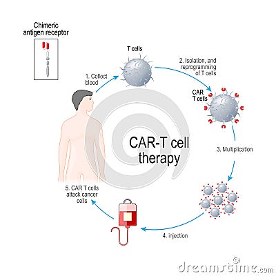 CAR T cell therapy. cancer immunotherapy. Artificial leukocyte receptors Vector Illustration