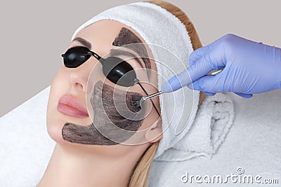 Carbon face peeling procedure in a beauty salon. Stock Photo