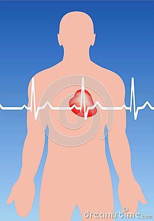 Cardiac arrhythmia Vector Illustration