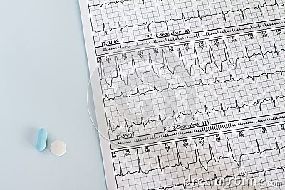 Cardiac arrhythmias recorded on paper. Ventricular Tachycardia Medicines on electrocardiograms. Medical desk Stock Photo