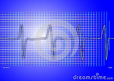 Cardiac graph blue Stock Photo