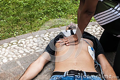 Cardiac massage Stock Photo