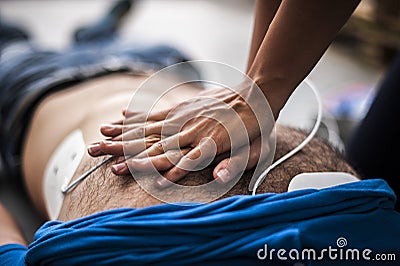 Cardiac massage Stock Photo