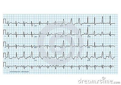 Cardio diagram Vector Illustration