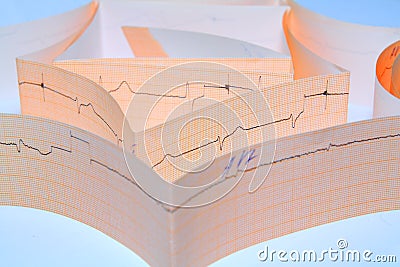 Cardiogram Stock Photo