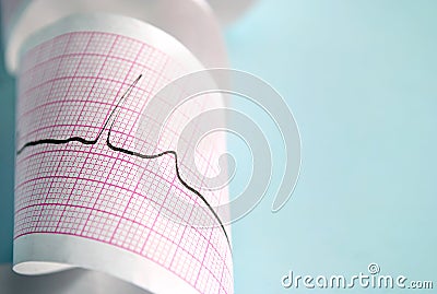 Cardiogram Stock Photo