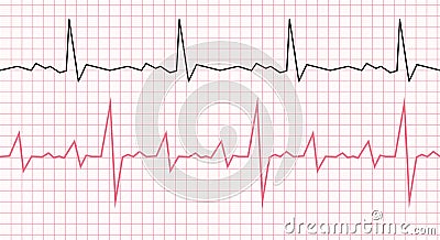 Cardiogram on a graph paper. Heartbeat line. Vector illustration Vector Illustration