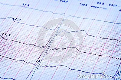Cardiogram of heart on paper. Stock Photo