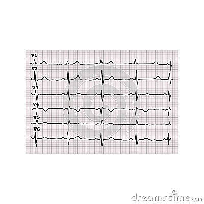 Cardiogram. Heartbeat. The graph on graph paper. Vector illustration on isolated background Vector Illustration