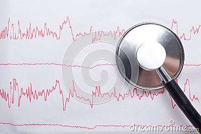 Cardiogram pulse trace and stethoscope concept for cardiovascular medical exam, closeup Stock Photo