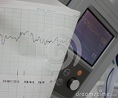 Cardiograph shows fetal heart rate Stock Photo