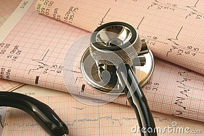 Cardiological test analysis #2 Stock Photo