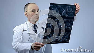 Cardiologist checking CT scan of blood vessels, heart disease, arrhythmia Stock Photo