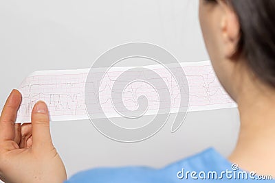 The cardiologist shows the film of an electrocardiogram of a patient with cardiac arrhythmia and bundle branch block. Heart and Stock Photo