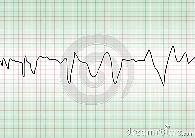 Cardiology test Vector Illustration