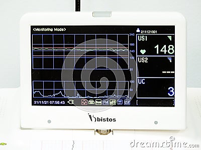 Cardiotocography device placed on mother's abdomen recording the fetal heart rate obtained via ultrasound transducer Editorial Stock Photo