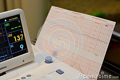 Cardiotocography device placed on mother's abdomen recording the fetal heart rate obtained via ultrasound transducer Editorial Stock Photo