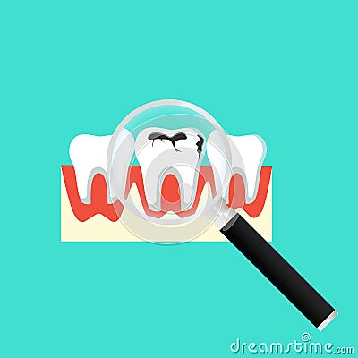 Caries dental problems. Tooth with caries icon with magnifier. Big hole in the human teeth on isolated background. EPS 10 vector Vector Illustration