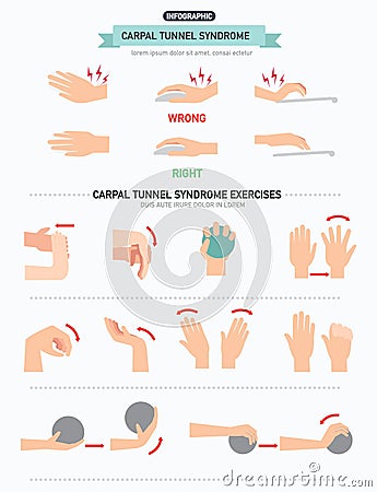 Carpal tunnel syndrome infographic Vector Illustration