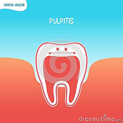 Cartoon bad tooth icon with pulpitis Stock Photo