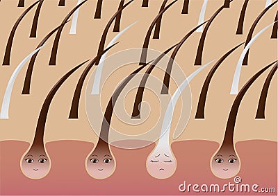 Cartoon hair follicles on the scalp suffering from pigmentation Vector Illustration