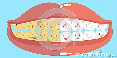 Cartoon health and tooth decay Vector Illustration