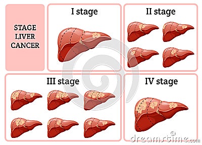 Cartoon Internal Human Organ Disease Concept Vector Illustration