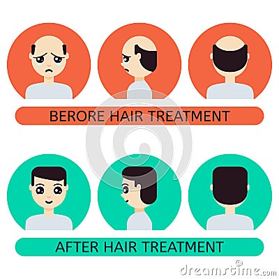 Cartoon man before and after hair treatment Cartoon Illustration