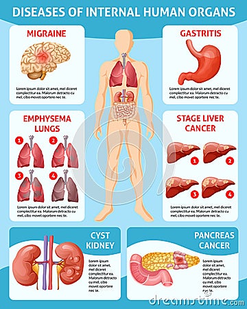 Cartoon Medical Care Infographic Concept Vector Illustration