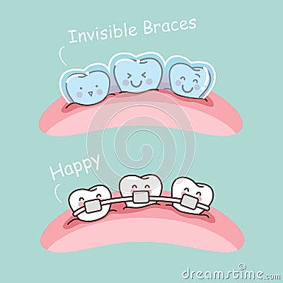 Cartoon tooth with invisible braces Vector Illustration