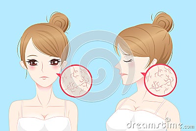 Cartoon woman with skin dry Vector Illustration