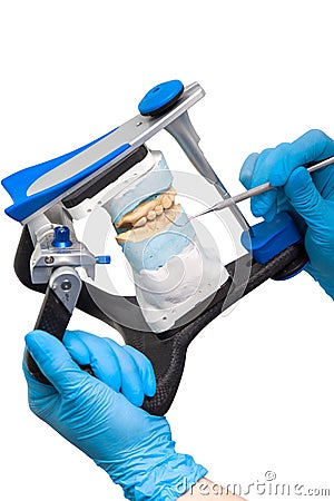 Cast teeth model is fixed in a holder Stock Photo