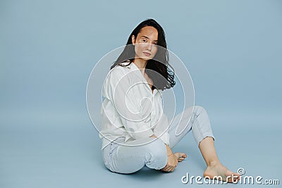 Casual beautiful vitiligo brunette sitting, presenting patchy part of her face Stock Photo