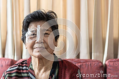Cataract elderly patient, Asian old senior woman having eye care treatment on Age-related eye diseases, AMD Stock Photo