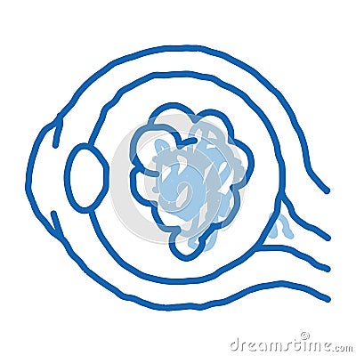 Cataract Eyes doodle icon hand drawn illustration Vector Illustration