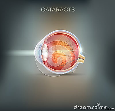 Cataracts abstract grey background Vector Illustration