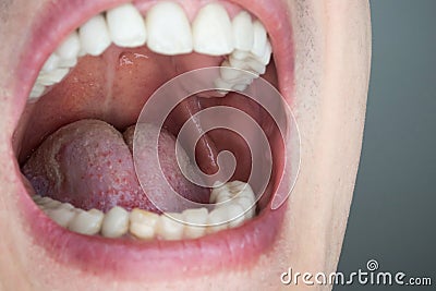 Caucasian male open oral cavity, close up shot Stock Photo