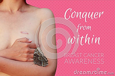 Caucasian woman with breast cancer scar on the pink background Stock Photo