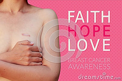 Caucasian woman with breast cancer scar on the pink background Stock Photo