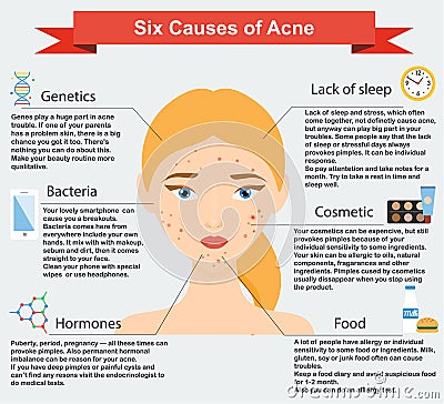 Causes of acne. Skin problems and diseases beauty infographics Vector Illustration