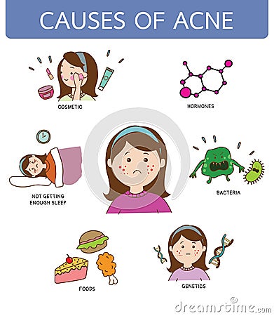 Causes of acne on women's face, illustration cartoon on white background Cartoon Illustration