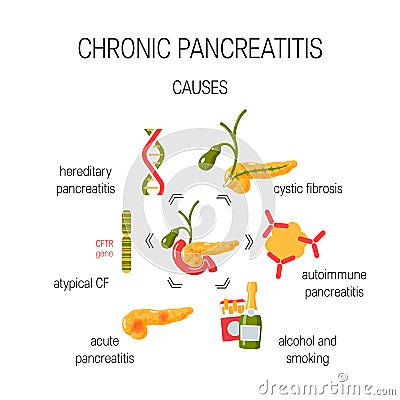 Causes of chronic pancreatitis concept. Vector illustration Vector Illustration
