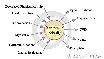 Causes and Consequences of Sarcopenia Obesity Stock Photo