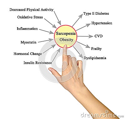 Causes and Consequences of Sarcopenia Obesity Stock Photo